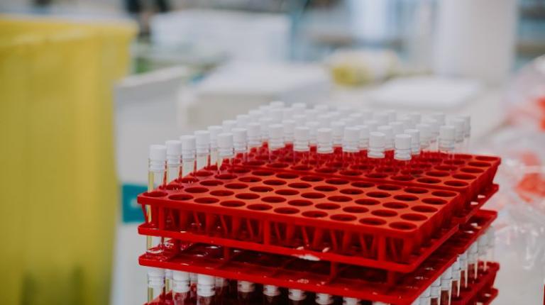 Test tubes for blood samples in a lab