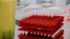 Test tubes for blood samples in a lab